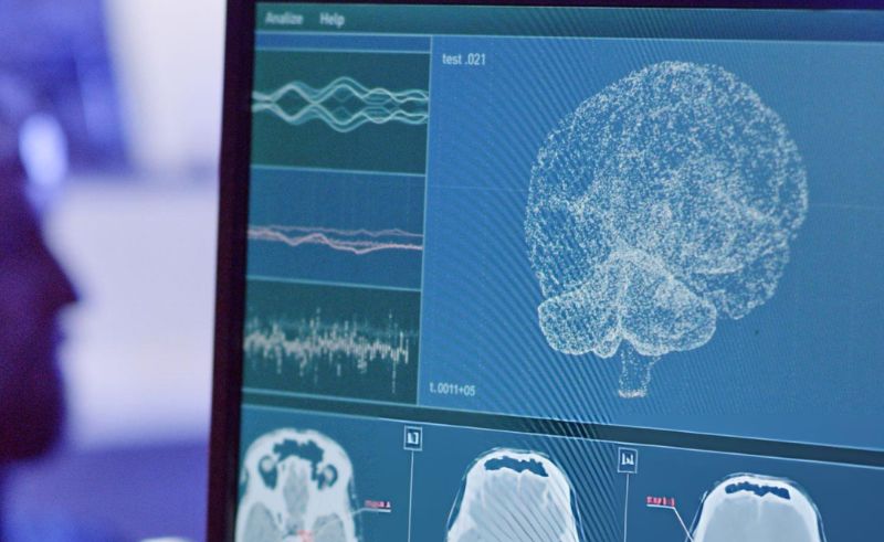 Saudi Study Develops AI Model to Detect Obstructive Sleep Apnea