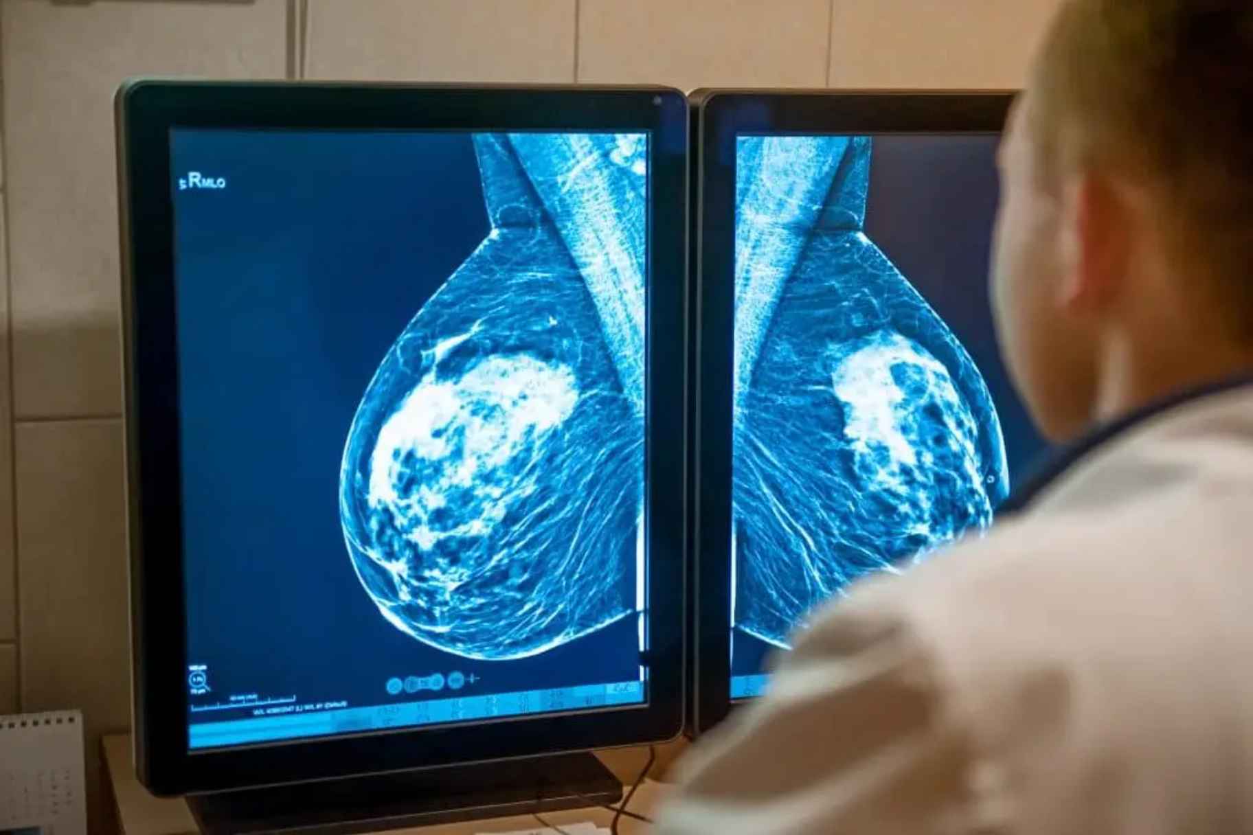 Emirates Health Services to Unveil AI Breast Cancer Detection Program